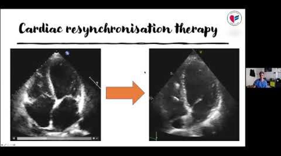 Embedded thumbnail for SOM/C3 breakfast meeting - Talk on Heart Failure and return to work.